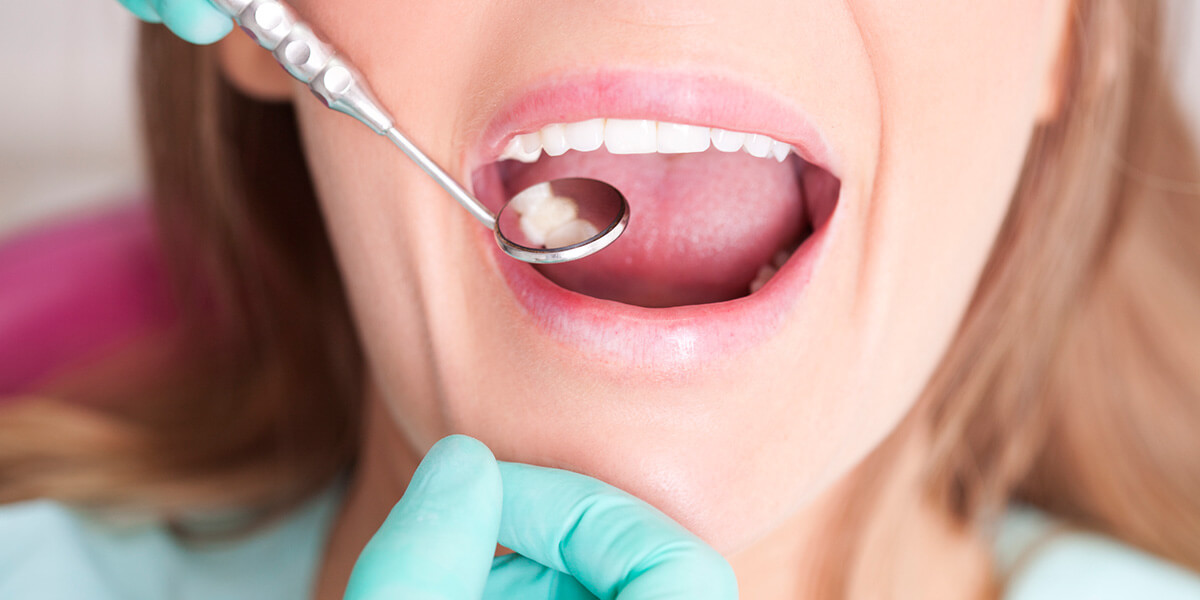 Tooth Fillings, Dental Services